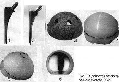 Эндопротез тазобедренного сустава ЭСИ